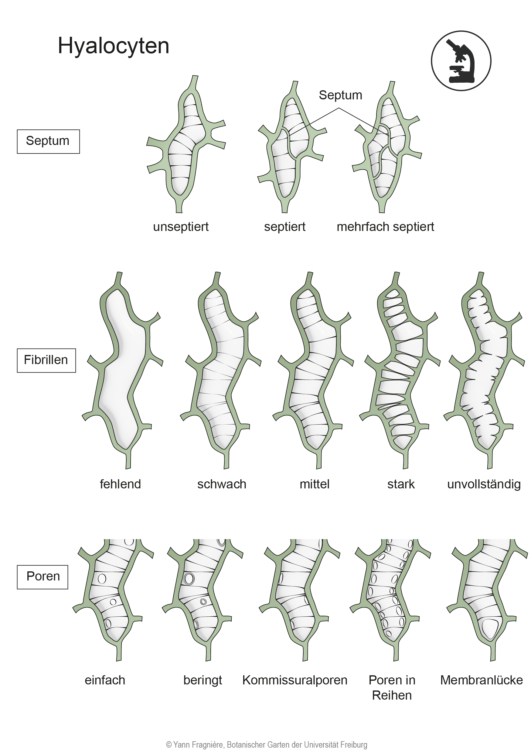 Cellules hyalocystes DE